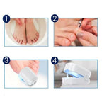Appareil de traitement au laser pour champignon des ongles